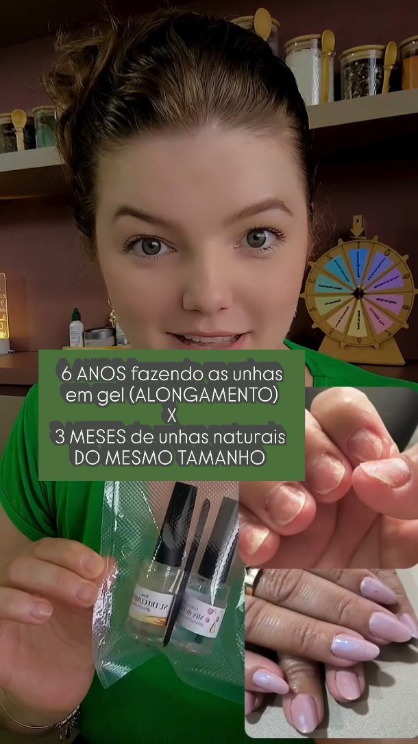 Unhas naturais de cliente, depois de anos de alongamento em gel